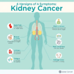 rak nerki objawy